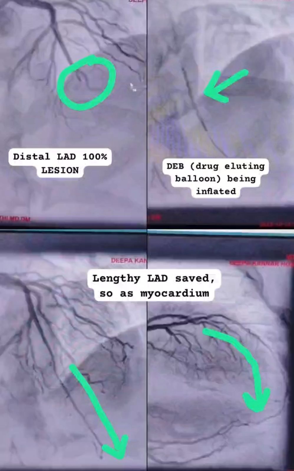 Medical Angiogram Image 6